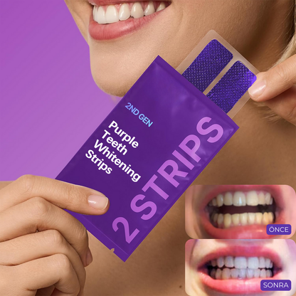 Diş beyazlatma şeritleri