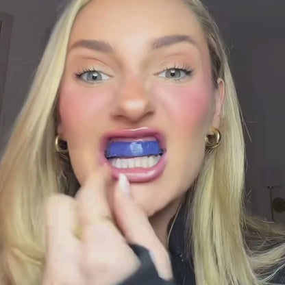 Diş beyazlatma şeritleri